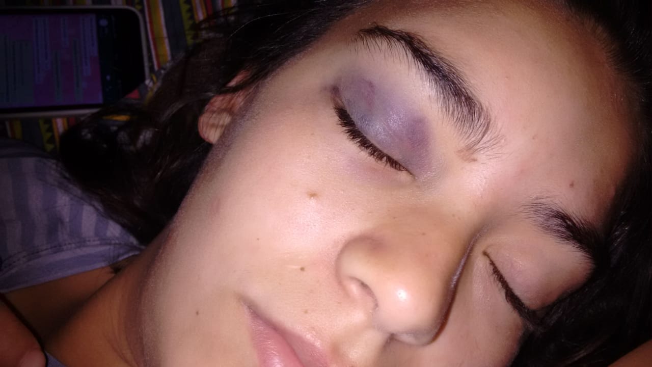 Motochorros despiadados: robaron y golpearon a una joven