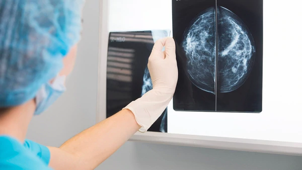 Ya están disponibles los resultados de las mamografías realizadas en 2019