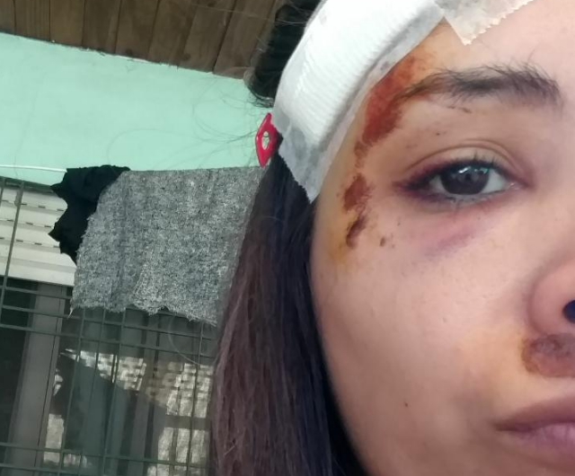 Una joven terminó inconsciente tras un violento intento de robo