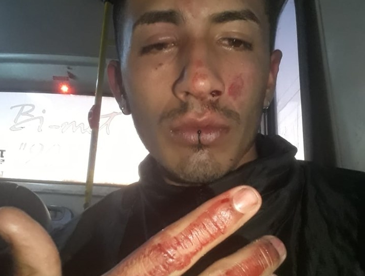 joven-golpeado-en-moreno