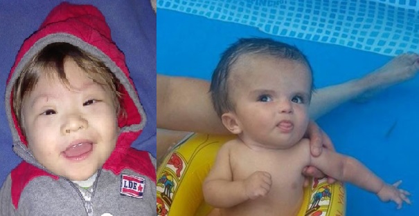 Piden ayuda por Bastian y Benjamín, dos nenes rodriguenses con patologías congénitas
