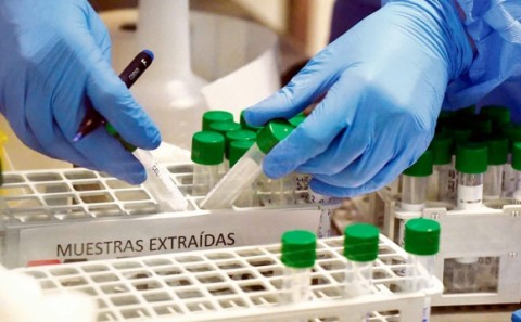 Se registraron 16 nuevos contagios de Covid-19 en Gral Rodríguez