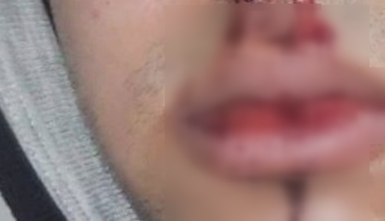 Denuncia por una golpiza a un adolescente en plena calle