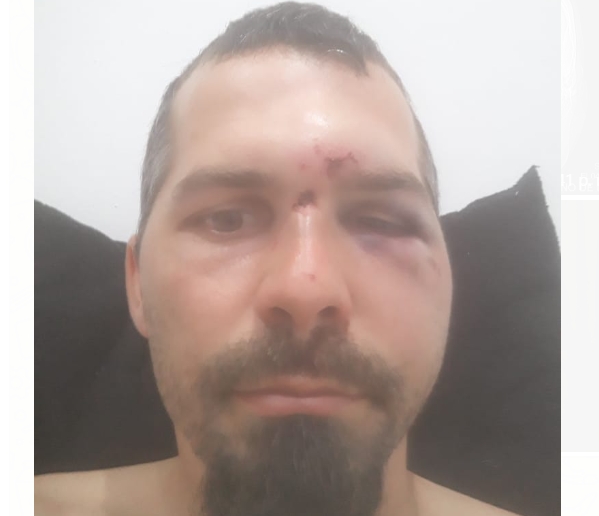 Conflicto por terreno en San Carlos: hombre denuncia golpiza, amenazas y pide Justicia