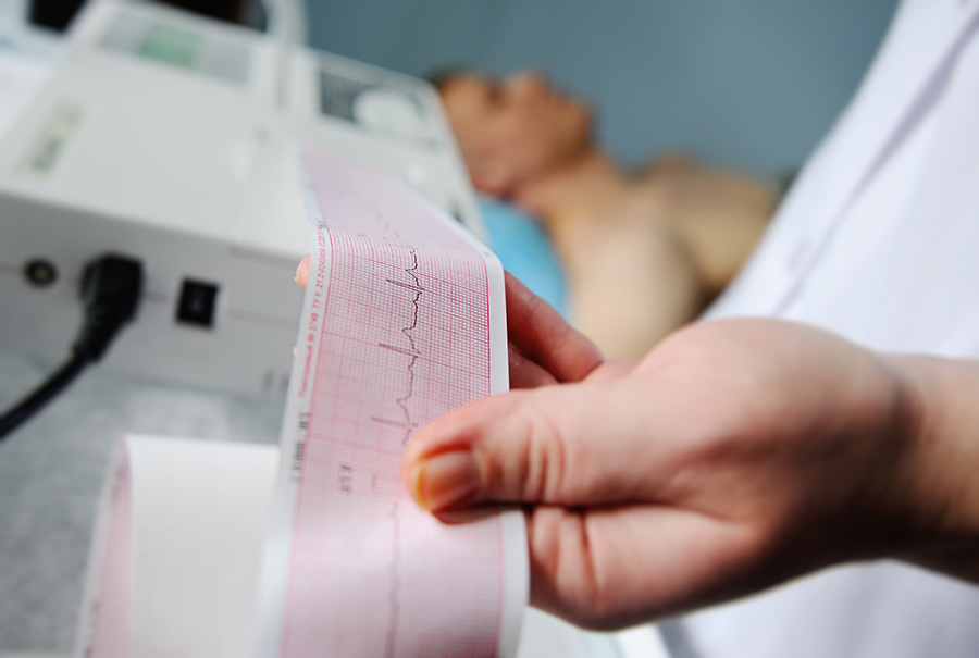 Nurse makes the patient cardiogram