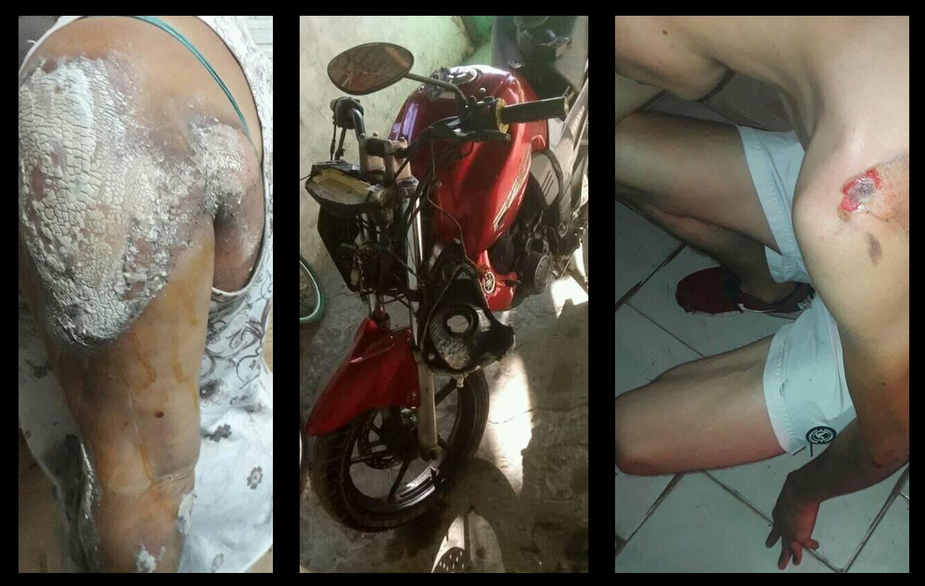 ACCIDENTE JOVEN Y MADRE - MOTO AUTO - NOVIEMBRE 2020 - 1
