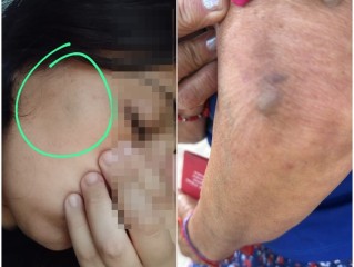 Conflicto vecinal de años acumula situaciones de violencia y temor: "mi mamá tiene ataques de pánico"