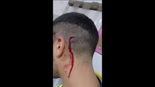 Lo golpearon con un fierro para robarle, denuncia acoso y teme por &ldquo;j&oacute;venes conflictivos&rdquo;