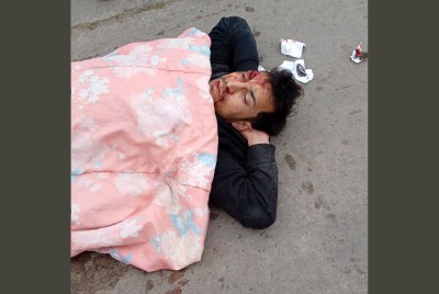 Buscan a testigos de un accidente con un joven herido: d&oacute;nde y cu&aacute;ndo ocurri&oacute;