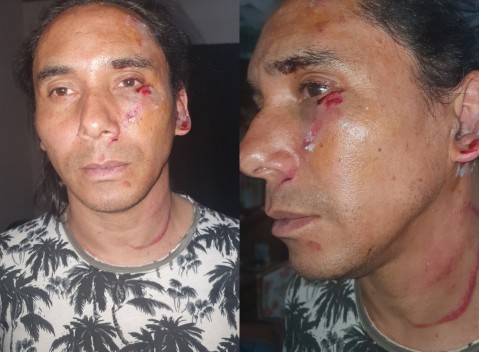 Un hombre sufrió un brutal ataque en la zona de la estación de General Rodríguez
