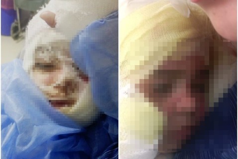 Operaron a Mateo, el nene que sufrió un grave accidente doméstico: cómo se encuentra