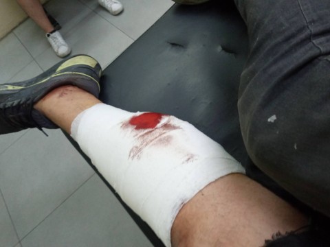 Vivir para contarlo: vecino rodriguense fue baleado en La Reja por motochorros