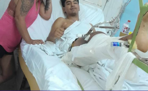 Tras un fuerte accidente en Ruta 7, un joven pide ayuda a la comunidad para su prótesis