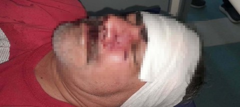 Un conflicto por la basura terminó con un vecino hospitalizado en el Vicente López