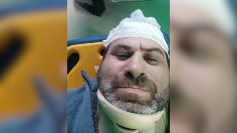 El complicado panorama de un vecino tras ser atropellado en Ruta 7