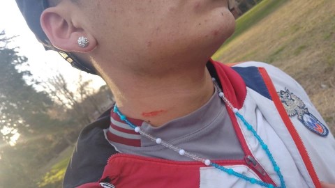 Estaba en la plaza con su amigo y los atacaron "en patota": todo quedó registrado