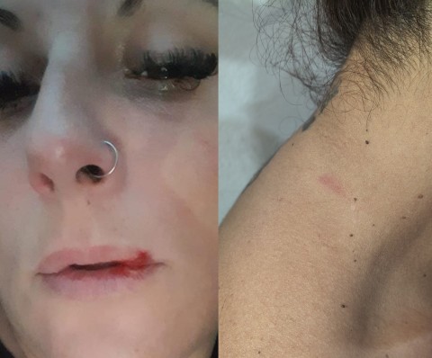 Mujer denunció que su ex pareja la atacó brutalmente en el estacionamiento del McDonald's de General Rodríguez