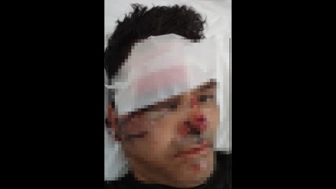 Le robaron la moto, fue a intentar recuperarla, y los delincuentes lo atropellaron con su propio rodado