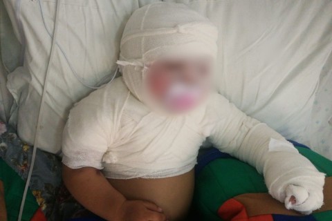 Otra criatura rodriguense está internada en La Plata tras un grave accidente doméstico