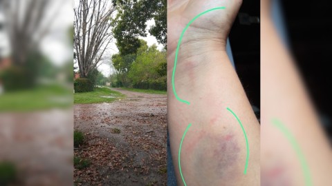 Violenta secuencia: le robaron, persiguió y redujo a la ladrona, que terminó demorada