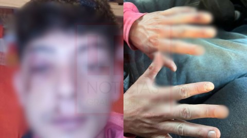 Joven fue brutalmente golpeado y asaltado a la salida de un bar c&eacute;ntrico