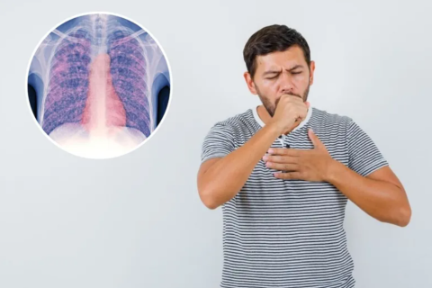Tuberculosis: qué hacer si tenés síntomas o si tuviste contacto con una persona enferma