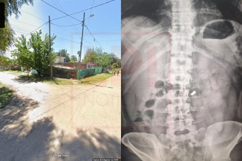 Asalto violento y balazo a un trabajador que fue derivado al Hospital Vicente López