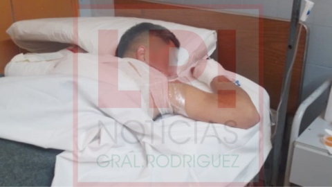 C&oacute;mo est&aacute; la salud del hombre al que quemaron con agua hirviendo