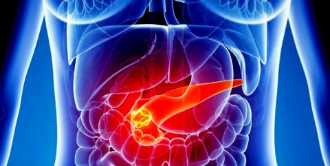 Especialistas bonaerenses alertaron por el avance del c&aacute;ncer de p&aacute;ncreas: c&oacute;mo prevenirlo