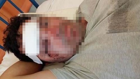 Cómo sigue el hombre atropellado al querer recuperar la moto que le habían robado