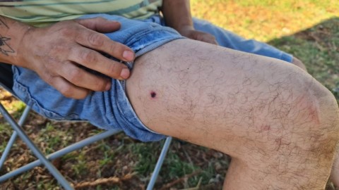 Vecino baleado relat&oacute; el salvaje enfrentamiento con delicuentes en Barrio La Posta