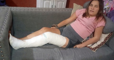 Est&aacute; inmovilizada y necesita ayuda urgente para operarse: qu&eacute; le pas&oacute; y c&oacute;mo colaborar