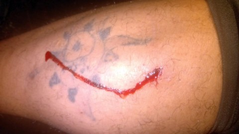 Grave denuncia de una mujer por violencia familiar y un "puntazo"