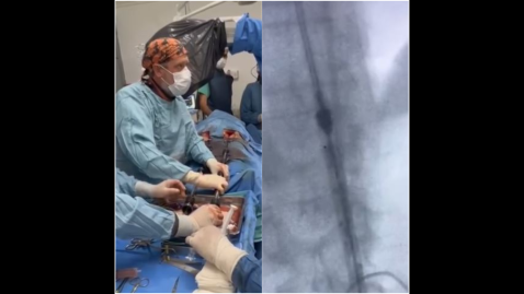 Video: otra cirugía histórica en el Hospital Vicente López y con aporte internacional