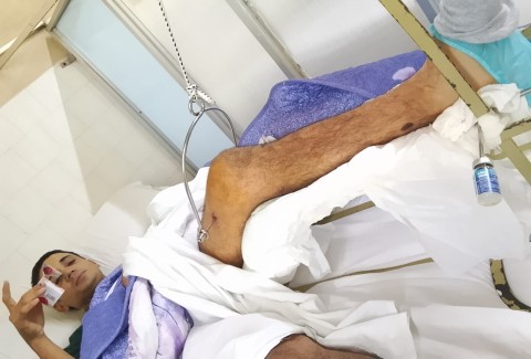 La cruzada de una familia para cubrir los gastos m&eacute;dicos de un joven gravemente accidentado un mes atr&aacute;s