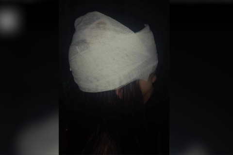 Video: la pesadilla de una mujer a la que una patota hirió para desalojarla de la casa