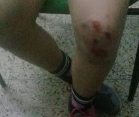 Denuncian una brutal golpiza a dos menores rodriguenses en Luján