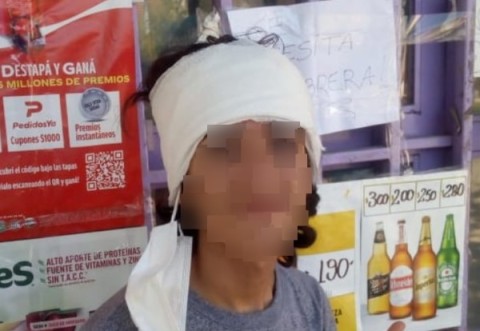 "Vamos a pelear": absurda y brutal agresión a un adolescente de 15 años en el Polideportivo Municipal