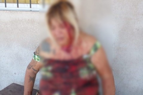 Locura en B° San Carlos: vecina denuncia que estrellaron un camión contra su casa y la golpearon con un palo de hockey