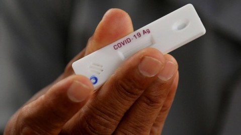 El Gobierno autorizó la venta de autotests de Covid-19: dónde se conseguirán y cuánto costarían