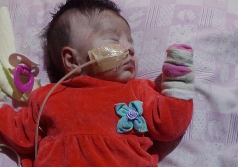 Humilde familia pide ayuda para proteger del frío a su bebé recién operada