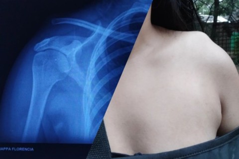 A contrarreloj: el desesperado pedido de ayuda de una joven rodriguense tras un accidente doméstico