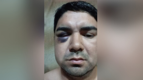 El Municipio despidió al coordinador que acusó a dos funcionarios de una brutal golpiza