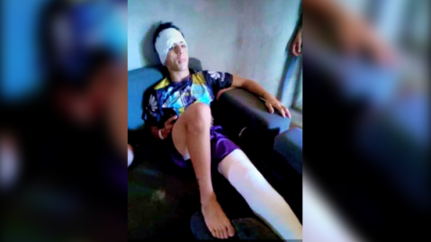Iba en moto a la casa de su novia, sufrió un tremendo choque en Ruta 7 y está vivo de milagro: su relato