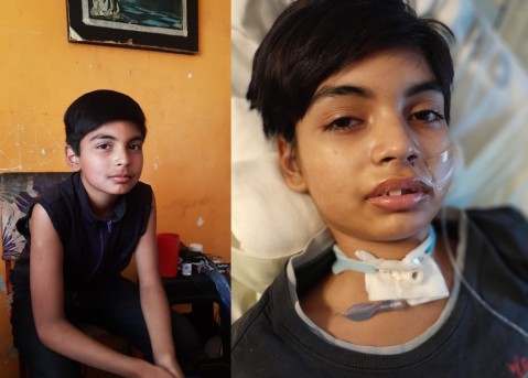 Tiene 13 años, un accidente doméstico le cambió la vida y ahora su familia hace un desesperado pedido