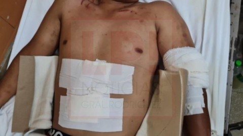 Intentó parar una pelea y fue apuñalado: huyó ensangrentado hasta caer en su casa en B° Selectos de Gaona