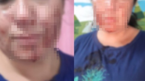 Violencia de género en el barrio Mi Rincón: una mujer sufrió un brutal ataque de su ex pareja