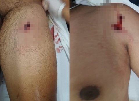 Feroz tiroteo y persecución provocó tensión en tres barrios y terminó con un ladrón baleado y detenido