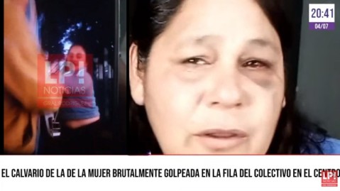 El calvario de la mujer brutalmente golpeada en la fila del colectivo: "mis hijas no quieren salir porque tienen miedo"