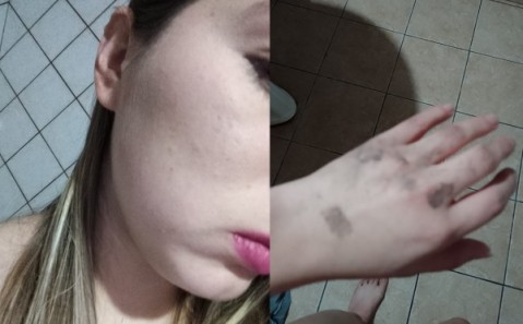 Discusi&oacute;n en un boliche, emboscada y brutal golpiza a dos j&oacute;venes rodriguenses en Luj&aacute;n